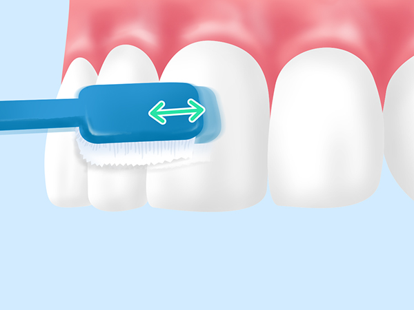 TBI（Tooth Brushing Instruction）
